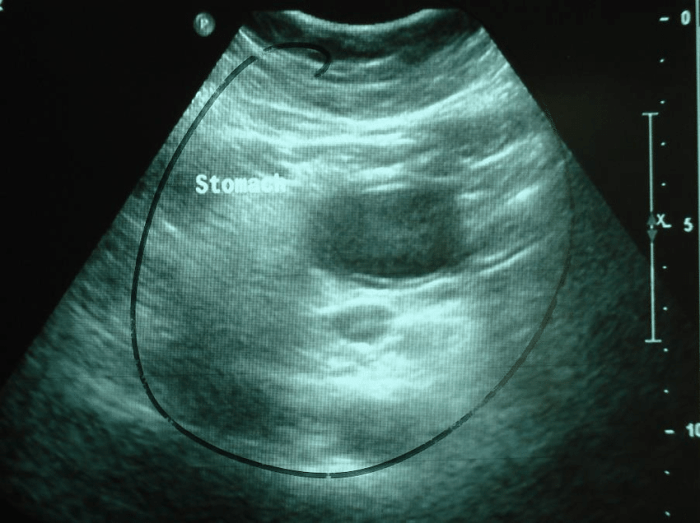 If an ultrasound probe contacts mucous membranes